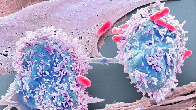 Dividing cancer cell. Coloured scanning electron micrograph (SEM) of a colorectal cancer cell undergoing mitosis (nuclear division) and splitting into two daughter cells (left and right). Here, it is in late telophase, the final stage before cell division (cytokinesis) and the two daughter cells are still connect by a cytoplasmic bridge (horizontal, centre). Bacteria (rod-shaped) can also be seen on the cells. Magnification: x2000 when printed at 10 centimetres wide. Image: STEVE GSCHMEISSNER/Science Photo Library/Getty Images